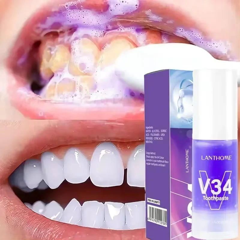 Clareador Dental – Sorriso Perfeito