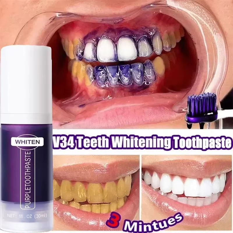 Clareador Dental – Sorriso Perfeito