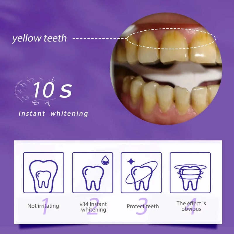 Clareador Dental – Sorriso Perfeito