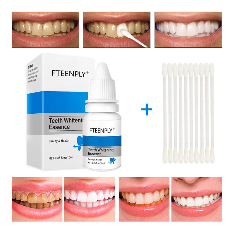 Clareador Dental – Sorriso Perfeito